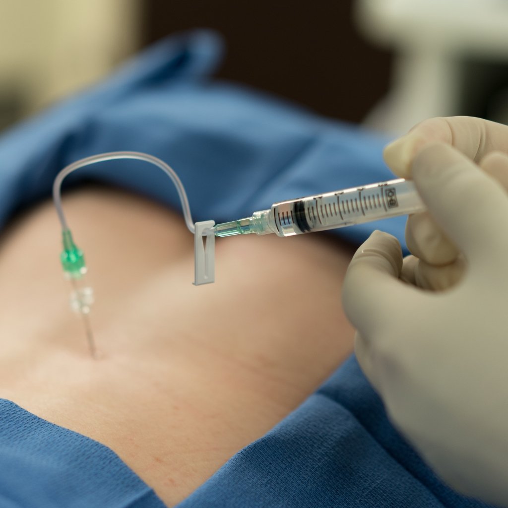 understanding painless normal delivery