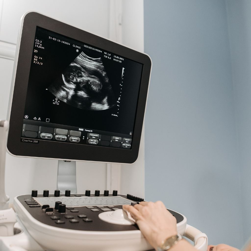 3d-4d sonography