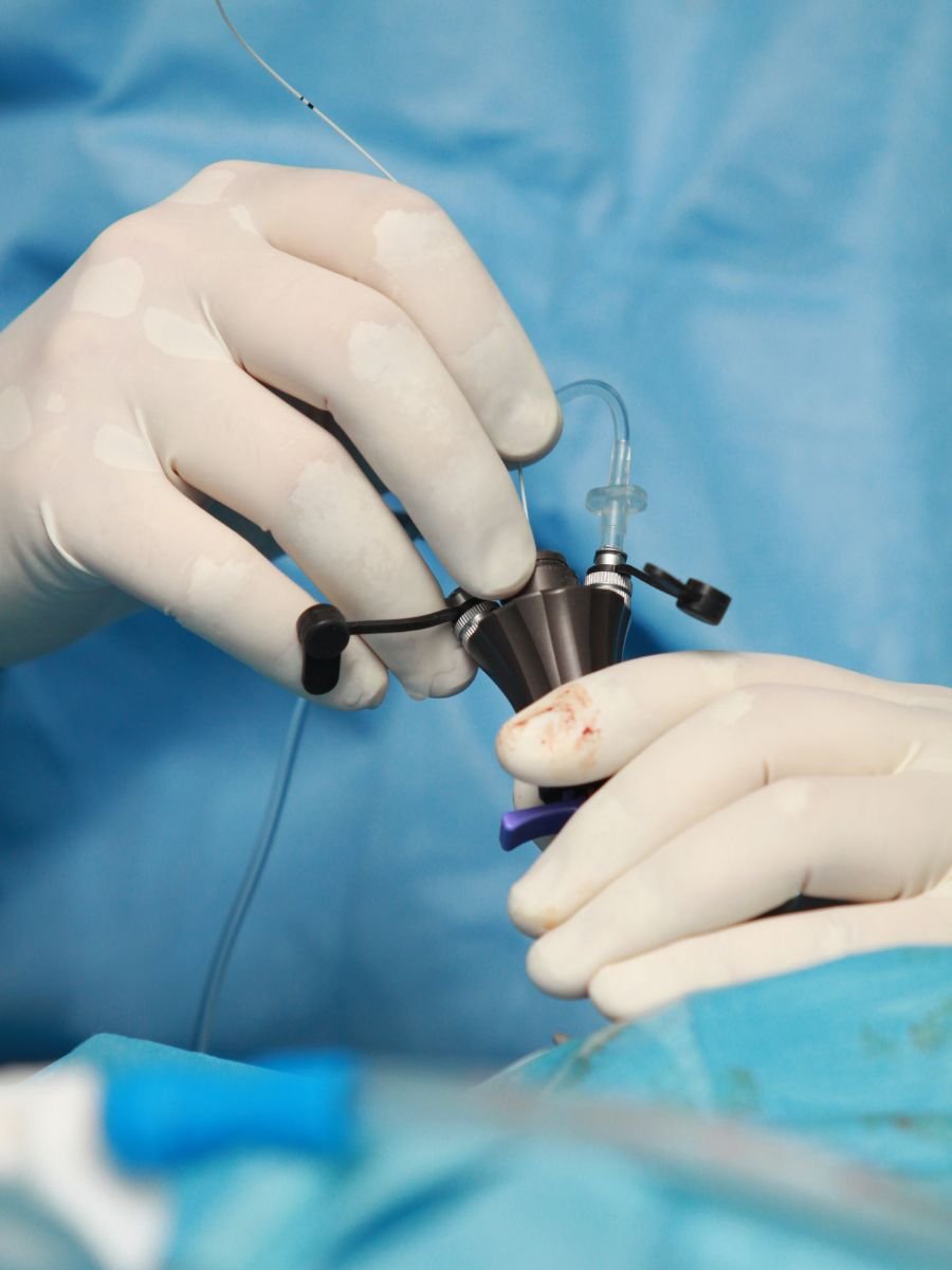 minimally invasive surgery